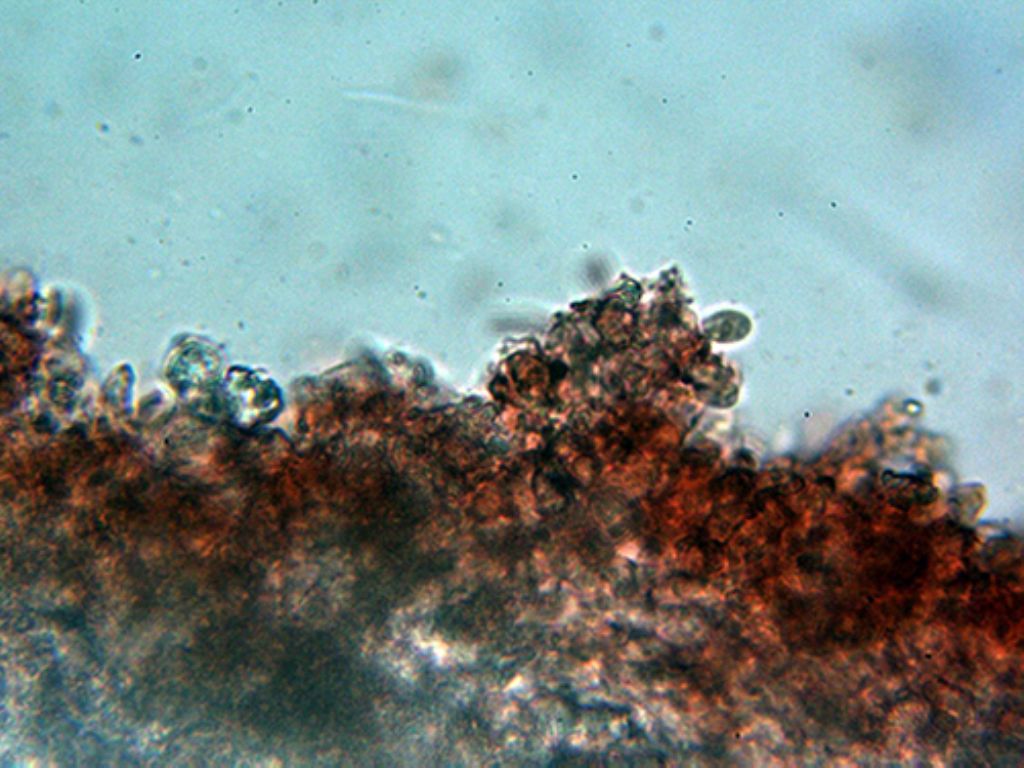 Hyphodontia microspora?
